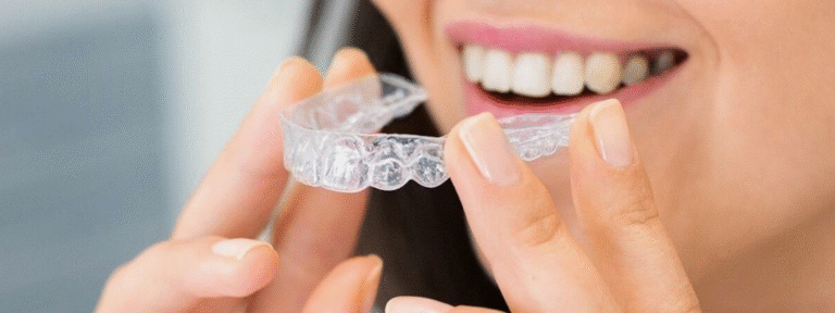 dental crowns-purple dental (5)